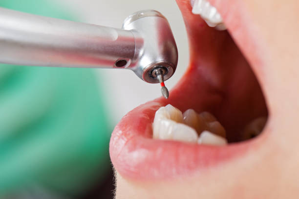 Best Emergency Broken Tooth Repair in New Holland, PA
